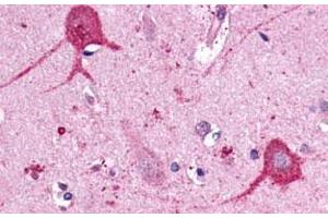 Immunohistochemical (Formalin/PFA-fixed paraffin-embedded sections) staining in human brain, neurons and glia with OPN3 polyclonal antibody . (OPN3 antibody  (C-Term))