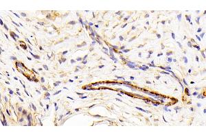 Immunohistochemistry (IHC) image for anti-Caldesmon 1 (CALD1) (AA 434-531) antibody (ABIN7440557)