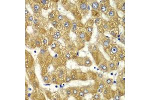 Immunohistochemistry (Paraffin-embedded Sections) (IHC (p)) image for anti-Myosin IC (MYO1C) (AA 769-1028) antibody (ABIN6144280)