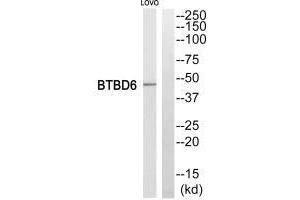 Western blot analysis of extracts from LOVO cells, using BTBD6 antiobdy. (BTBD6 antibody)