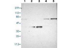 Western blot analysis of Lane 1: RT-4, Lane 2: U-251 MG, Lane 3: A-431, Lane 4: Liver, Lane 5: Tonsil with NCF2 polyclonal antibody (PAB28551). (NCF2 antibody)