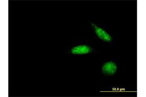 Immunofluorescence of purified MaxPab antibody to ZNF447 on HeLa cell. (ZSCAN18 antibody  (AA 1-510))