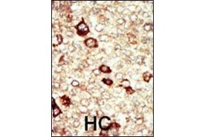 Immunohistochemistry (Paraffin-embedded Sections) (IHC (p)) image for anti-Fibroblast Growth Factor Receptor 4 (FGFR4) (AA 24-55), (N-Term) antibody (ABIN391970)