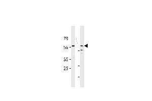 HCDC7L1 Antibody (M9) (ABIN1882165 and ABIN2841618) western blot analysis in HT29,MCF-7 cell line lysates (35 μg/lane). (CDC7 antibody  (N-Term))