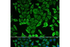 Immunofluorescence analysis of MCF-7 cells using RARS Polyclonal Antibody (RARS antibody)