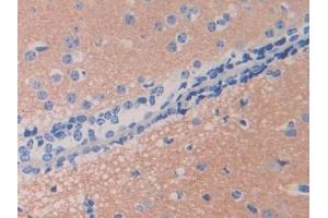 DAB staining on IHC-P; Samples: Mouse Cerebrum Tissue (UCHL5 antibody  (AA 66-268))