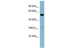 KLK10 antibody used at 1 ug/ml to detect target protein. (Kallikrein 10 antibody  (N-Term))