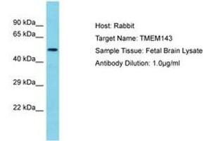 Image no. 1 for anti-Transmembrane Protein 143 (TMEM143) (AA 39-88) antibody (ABIN6750625) (TMEM143 antibody  (AA 39-88))