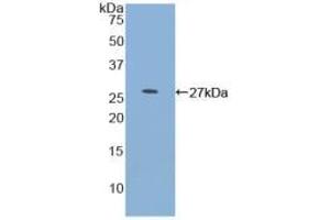 Western blot analysis of recombinant Human MYOC. (MYOC antibody  (AA 224-471))