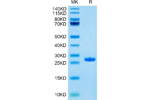 Adipsin Protein (AA 26-253) (His tag)
