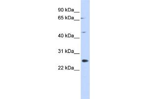 WB Suggested Anti-SPATA22 Antibody Titration: 0. (SPATA22 antibody  (N-Term))