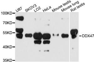 Western blot analysis of extracts of various cell lines, using DDX47 antibody. (DDX47 antibody)
