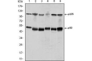 Western blot analysis using NFKB1 mouse mAb against K562 (1), Jurkat (2), A431 (3), Hela (4), THP-1 (5) and MCF-7 (6) cell lysate. (NFKB1 antibody)