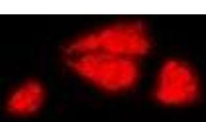 Immunofluorescent analysis of DAX1 staining in MCF7 cells. (NR0B1 antibody)