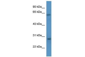 WB Suggested Anti-Cish Antibody Titration: 0. (CISH antibody  (N-Term))