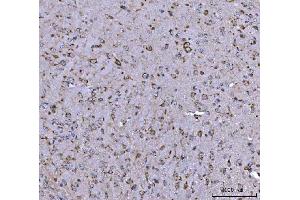 IHC analysis of BBS9 using anti-BBS9 antibody (ABIN7601518). (BBS9 antibody  (AA 37-793))