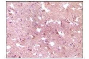 Immunohistochemical analysis of paraffin-embedded human Alzheimer brain tissue, showing cytoplasmic localization using APP mouse mAb with DAB staining.