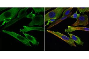 ICC/IF Image Stathmin 1 antibody detects Stathmin 1 protein at cytoplasm by immunofluorescent analysis.