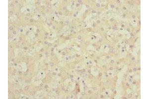 Immunohistochemistry of paraffin-embedded human liver tissue using ABIN7147123 at dilution of 1:100 (CD166 antibody  (AA 28-180))