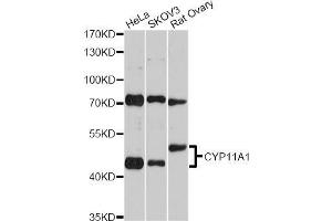 Western blot analysis of extracts of various cell lines, using CYP11A1 Antibody (ABIN5970856) at 1/2000 dilution. (CYP11A1 antibody)