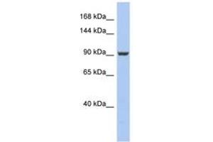 Image no. 1 for anti-PMS2 Postmeiotic Segregation Increased 2 (S. Cerevisiae) (PMS2) (AA 611-660) antibody (ABIN6743977) (PMS2 antibody  (AA 611-660))