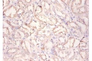 Immunohistochemistry of paraffin-embedded human kidney tissue using ABIN7154210 at dilution of 1:100 (PYGL antibody  (AA 2-846))