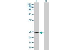 Western Blot analysis of SSR2 expression in transfected 293T cell line by SSR2 MaxPab polyclonal antibody. (SSR2 antibody  (AA 1-186))