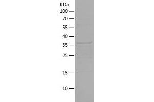 Western Blotting (WB) image for Glutamate-Ammonia Ligase (GLUL) (AA 228-373) protein (His-IF2DI Tag) (ABIN7123112) (GLUL Protein (AA 228-373) (His-IF2DI Tag))