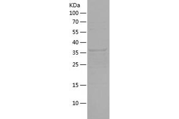 GLUL Protein (AA 228-373) (His-IF2DI Tag)