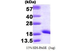 Figure annotation denotes ug of protein loaded and % gel used. (NME1 Protein (AA 1-152))