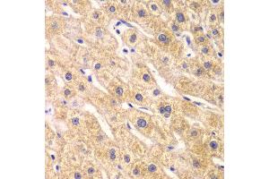 Immunohistochemistry of paraffin-embedded human liver injury using RPS7 antibody at dilution of 1:100 (x40 lens).
