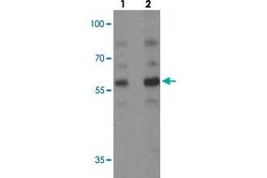 Western blot analysis of PLAGL2 in rat brain tissue with PLAGL2 polyclonal antibody  at (1) 1 and (2) 2 ug/mL. (PLAGL2 antibody  (N-Term))