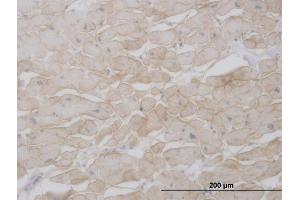Immunoperoxidase of monoclonal antibody to SGCB on formalin-fixed paraffin-embedded human heart. (SGCB antibody  (AA 1-318))