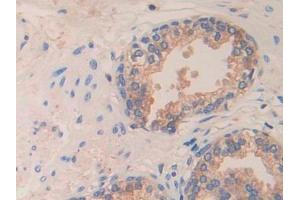Used in DAB staining on fromalin fixed paraffin- embedded prostate gland tissue (HEXB antibody  (AA 122-311))