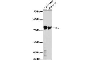 Western blot analysis of extracts of various cell lines, using REL antibody (ABIN3021649, ABIN3021650, ABIN3021651 and ABIN6215485) at 1:1000 dilution. (c-Rel antibody  (AA 1-300))