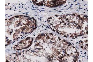 Image no. 1 for anti-Sequestosome 1 (SQSTM1) antibody (ABIN1499988) (SQSTM1 antibody)