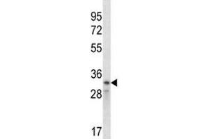 Cyclin D2 antibody western blot analysis in CEM lysate (Cyclin D2 antibody  (AA 1-30))