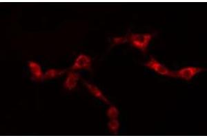 ABIN6276441 staining  SKOV3 cells by IF/ICC. (GRP94 antibody  (C-Term))