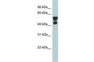 Image no. 1 for anti-Platelet-Activating Factor Acetylhydrolase 1b, Regulatory Subunit 1 (45kDa) (PAFAH1B1) (AA 71-120) antibody (ABIN6743973) (PAFAH1B1 antibody  (AA 71-120))