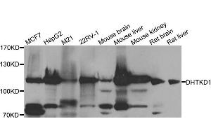 Western blot analysis of extracts of various cell lines, using DHTKD1 antibody. (DHTKD1 antibody)