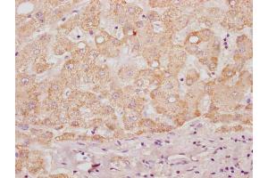 IHC image of ABIN7155014 diluted at 1:100 and staining in paraffin-embedded human liver tissue performed on a Leica BondTM system. (HS3ST3B1 antibody  (AA 54-390))