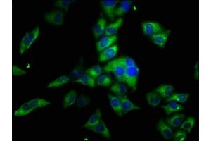 Immunofluorescence staining of Hela cells with ABIN7162115 at 1:33, counter-stained with DAPI. (Obscurin antibody  (AA 1621-1712))
