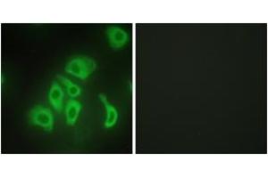 Immunofluorescence analysis of HepG2 cells, using TNFA Antibody. (TNF alpha antibody  (AA 141-190))