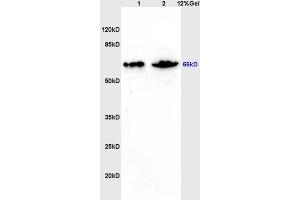 L1 rat brain lysates L2 mouse intestine lysates probed with Anti ZNF300 Polyclonal Antibody, Unconjugated (ABIN671091) at 1:200 overnight at 4 °C. (ZNF300 antibody  (AA 165-250))