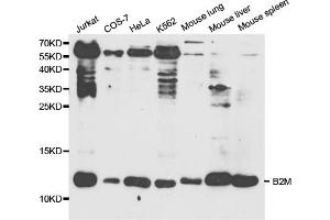 Western blot analysis of extracts of various cell lines, using B2M antibody (ABIN5970743) at 1/1000 dilution. (beta-2 Microglobulin antibody)