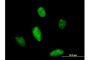 Immunofluorescence of monoclonal antibody to ATOH1 on HeLa cell. (ATOH1 antibody  (AA 266-354))