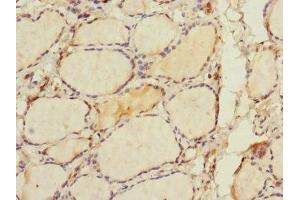 Immunohistochemistry of paraffin-embedded human thyroid tissue using ABIN7168009 at dilution of 1:100
