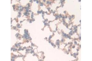 Used in DAB staining on fromalin fixed paraffin- embedded Kidney tissue (CD97 antibody  (AA 191-304))