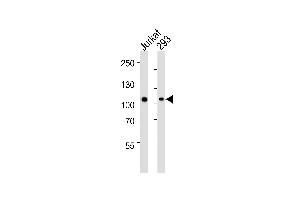 Western blot analysis of lysates from Jurkat, 293 cell line (from left to right), using GED1 Antibody (Center) (ABIN1944790 and ABIN2838530). (MAGED1 antibody  (AA 20-224))