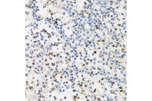 Immunohistochemistry of paraffin-embedded human appendicitis using SUMO4 Antibody. (SUMO4 antibody)